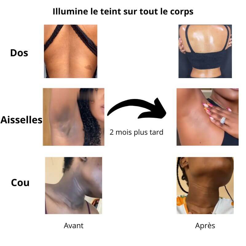 Lot de 2 Tampons Clarifiant au Curcuma Mesandro™